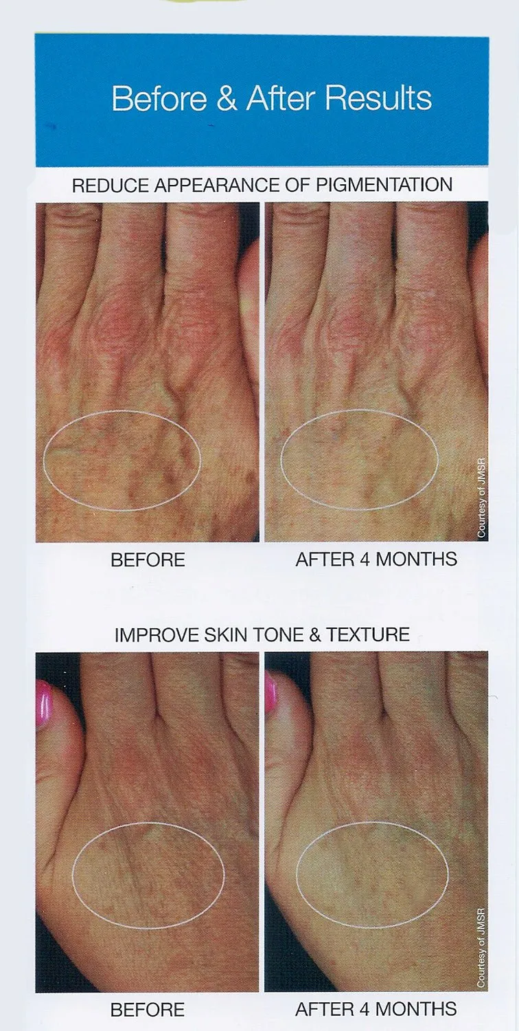 Marini ReNu Corrective Hand Complex